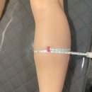 혜스테틱