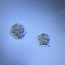시험관일기18 부천마리아 3일 배아 2개 신선이식 후기