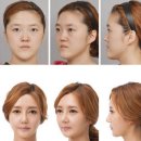 렛미인 - 연수구 | 렛미인
