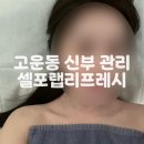 리프레시 | [세종] 고운동 웨딩 촬영 전 신부 붓기 관리 추천 셀포랩 리프레시 후기