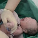 전인병원 | 대전 더블유여성병원 입원실 제왕절개 1일차 후기