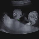 차부약국 | 동탄 산부인과 아기준비 및 초음파 잘보는 곳(병원만 9군데 다닌 엄마)