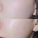 딥스킨 이미지
