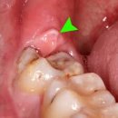 서울턱사랑니치과의원 이미지