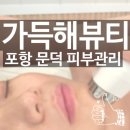 가득해(HYE)뷰티 | 포항 문덕 피부관리 가득해HYE뷰티 소노 트리플 물방울 리프팅