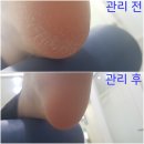 푸스올