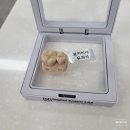 M치과기공소 | 치과 인레이 치료 후기