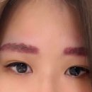 고운세상김양제장봉석피부과의원 네이버블로그