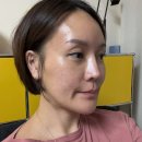 삼성더블의원 | [뷰티]삼성더블의원 미백레이져 내돈내산 10회 후기!!