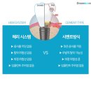 마이크로치과기공소 네이버블로그