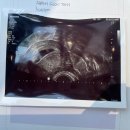 수정 | 인공수정 후기 1차 성공 대전 서울여성병원