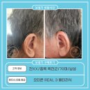 굿모닝 보청기 옥천점 | 옥천군 보청기, 천 XX 고객님 오티콘 REAL 3 배터리식 구매후기(70대, 男)