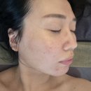 마온에스테틱 | 양산 마온에스테틱 윤곽관리 얼굴 좌우 밸런스 확실히 달라진후기