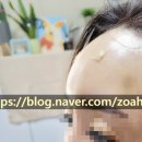 박현정치과의원 | 구리이마필러후기#톡스앤필구리후기