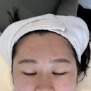 휴앤미 | 화사한 피부와 작은 얼굴! 동탄 휴앤미 에스테틱 관리 받았어요