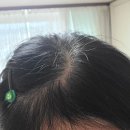 피부트러블과 머리빠짐에 도음을 주는 디알유황약초비누 입니다 이미지