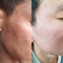 인셀덤뷰티하우스점 | [역곡피부관리] 바르는 보톡스 ~ 성형이필요없는 인셀덤. 유해성분0프로 .그린등급***