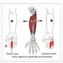 Flexor Digitorum Superficialis (천지굴근) 이미지