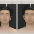 사각턱 말고 자연스러운 귀족턱 만드는 위뷰티 셀프 마사지