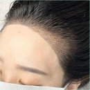 향헤어라인