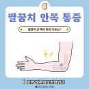 가양바른성모정형외과의원 | 가양역정형외과ㅣ팔꿈치 안 쪽 욱씬거리는 통증 원인, 골프엘보 증상