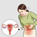 경희연경한의원 | 양산 생리통 한의원에서 본 소양인 생리통, 어혈에 단삼이 잘 듣는 이유