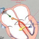 드림원탑 성인간호학1 ECG 마스터