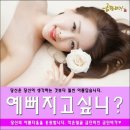 금단비가