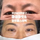 남천홍반장 | 부산 남구 반영구 눈썹문신 잘 하는 아미아토&amp;미토에스테틱 후기