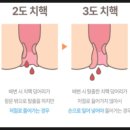 상쾌한장문외과
