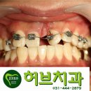 허브치과 이미지