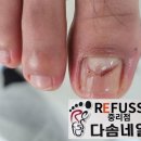대전레푸스다솜네일 이미지