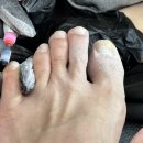 주안네일 :: 아트 많은 오늘머해 네일샵에서 내성발톱치료+여름패디 후기
