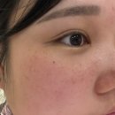 2200 | 패치파이 아이백 리쥬셀 크리스탈 패치 2200 사용 후기, 결혼 전 눈가 관리 시작!