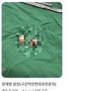 뿌리깊은치과의원 | 동탄사랑니치과, “생각보다 안 아팠다”는 후기가 나오는 이유