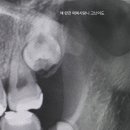 톡톡사랑니치과의원 이미지