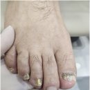 까망속눈썹&네일 | 대전 태평동 발톱무좀 남자발관리 추천하는 곳 닥터아이티엔 네일 까망아트