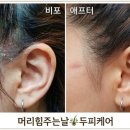 머리힘주는날 | [안양미용실] 지긋지긋한 비듬·두피 각질 안녕! '머리힘주는날'에서 환생한 후기
