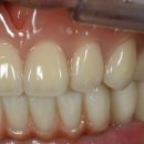 리더스덴쳐 기공소 이미지