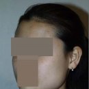 제이제이 이재화성형외과