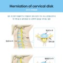 큰나무한의원 이미지