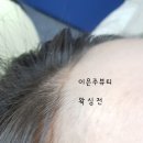 이은주헤어라인