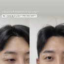 지에스25서초현대점 | 강남 남자 눈썹 잘하는 곳 끌리움에서 얼굴형에 맞는 눈썹 시술 후기