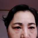 수원이안과의원 이미지