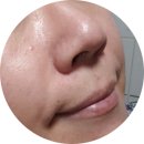쥬베라 코스메틱(Juvera Cosmetic) | 진동클렌저 쥬베라 블랙헤드제거피부가 매끈해진 후기