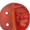 Streptococcus pyogenes -Group A _ Ba﻿citracin﻿﻿﻿ test 이미지