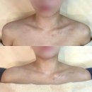 진주 신부관리 승모근 팔뚝관리 추천 평거동 ‘차크란 에스테틱’ 드레스라인 웨딩케어 받고 왔어요