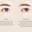 라이블리성형외과의원 이미지