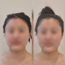 [파주윤곽관리] 뷰티선 1회만으로도 효과 직방! 윤곽 선 테라피 후기