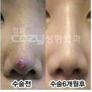 손수코 이미지